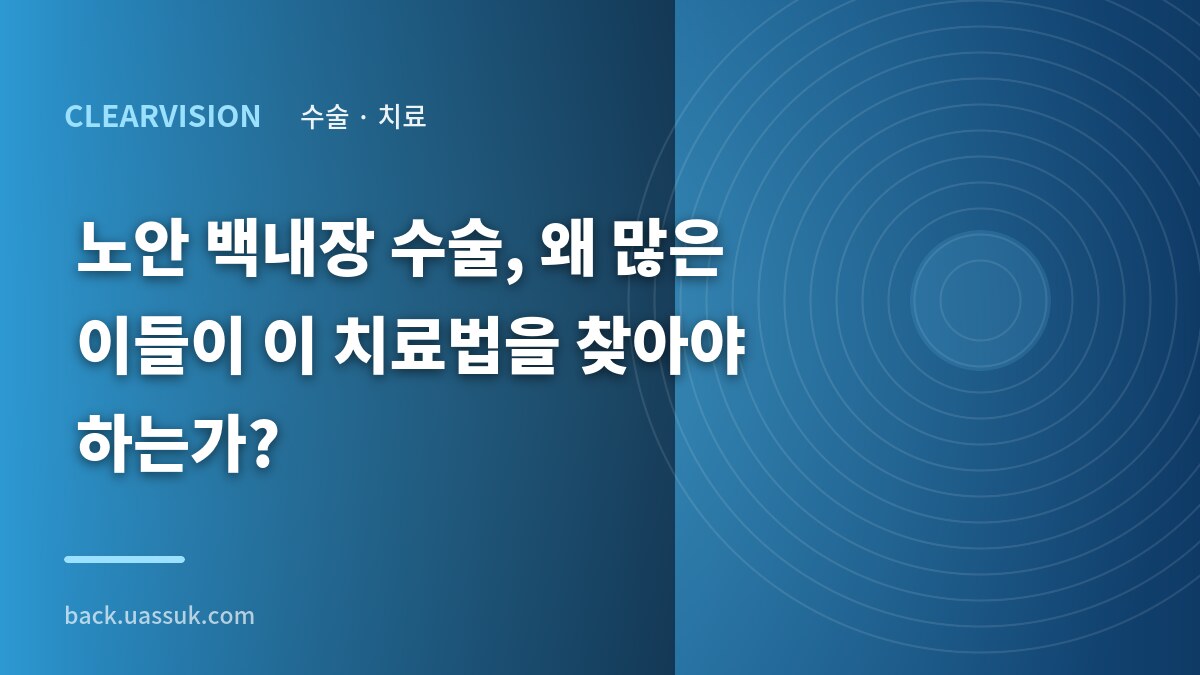 노안 백내장 수술, 왜 많은 이들이 이 치료법을 찾아야 하는가?