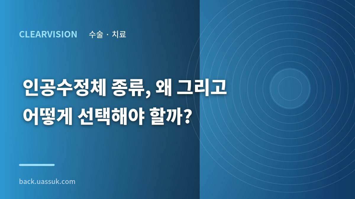 인공수정체 종류, 왜 그리고 어떻게 선택해야 할까?